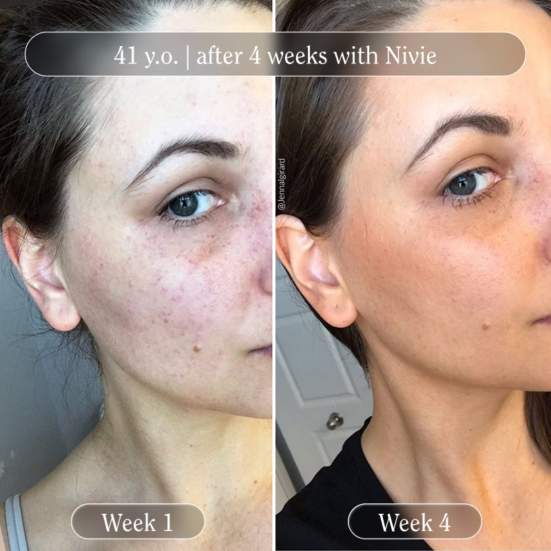 Nivie | Tan Drops