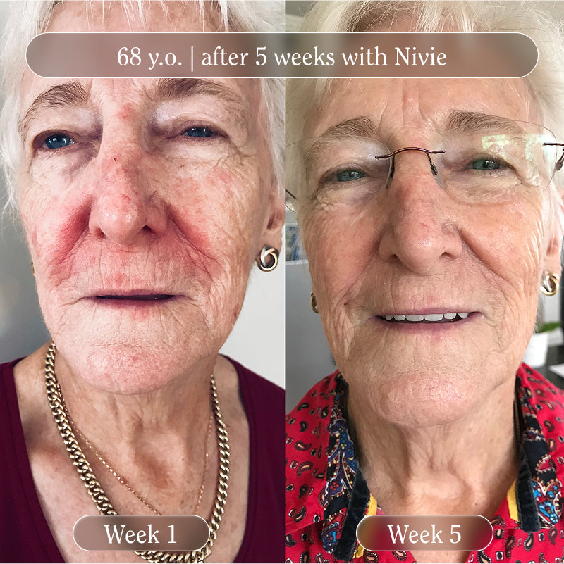 Nivie | Tan Drops