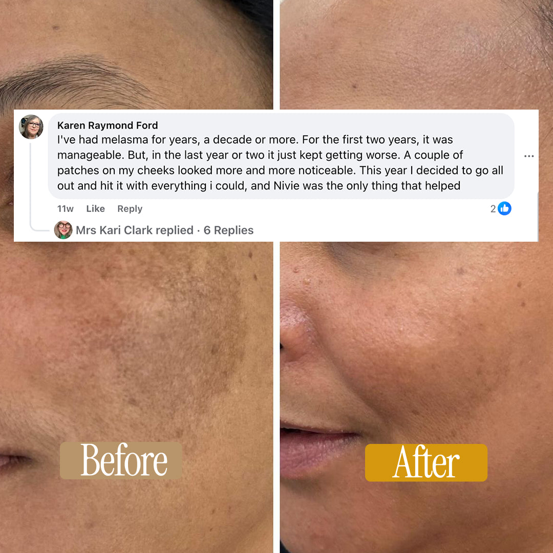 Nivie | Skin Nutrition Drops